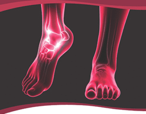 Foot & Ankle Education Seminar